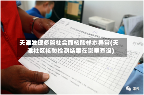 天津发现多管社会面核酸样本异常(天津社区核酸检测结果在哪里查询)-第2张图片