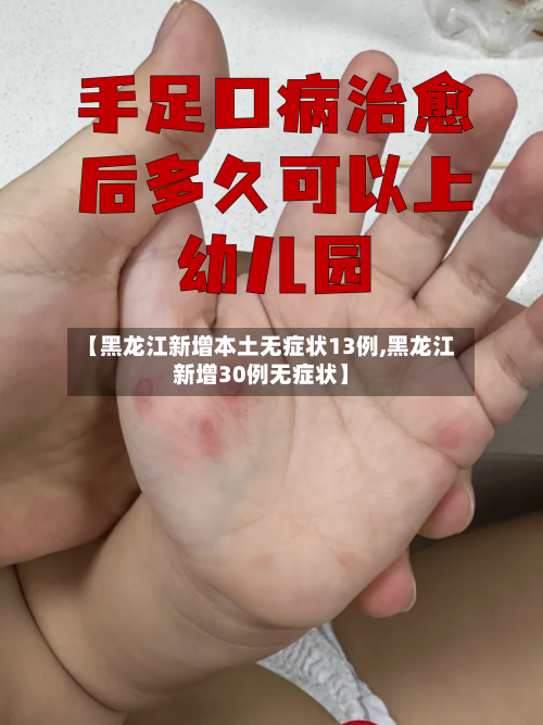 【黑龙江新增本土无症状13例,黑龙江新增30例无症状】-第2张图片